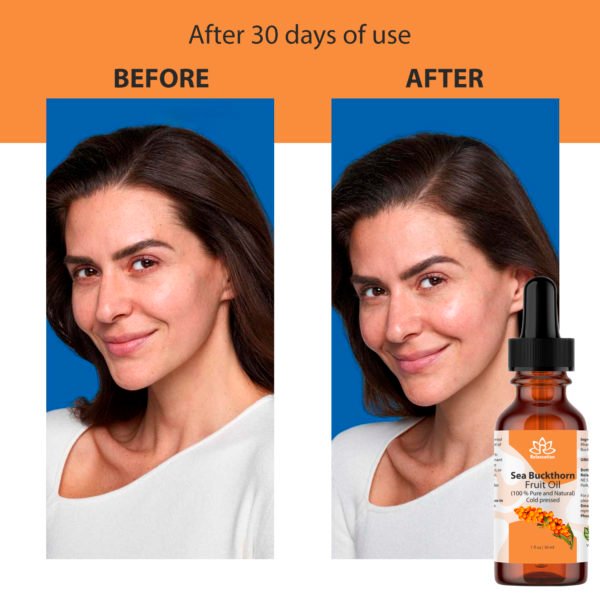 Organic Sea Buckthorn Essential Oil - Image 5