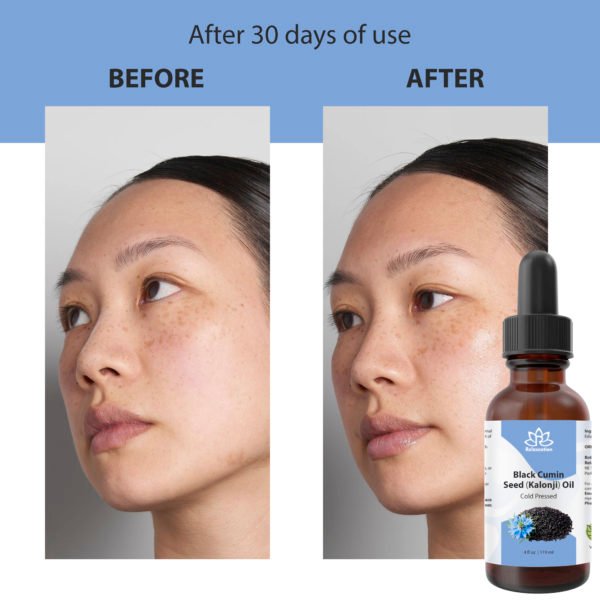Black Cumin Seed Oil - Image 10