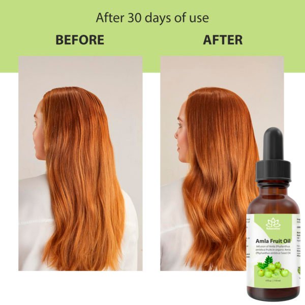 Amla Fruit Oil - Image 9