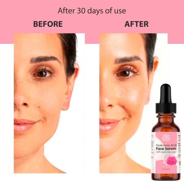 Hyaluronic Acid Serum with Rose Water - Image 10