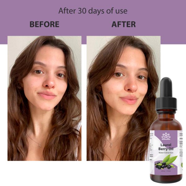 Pure Laurel Berry Oil - Image 9