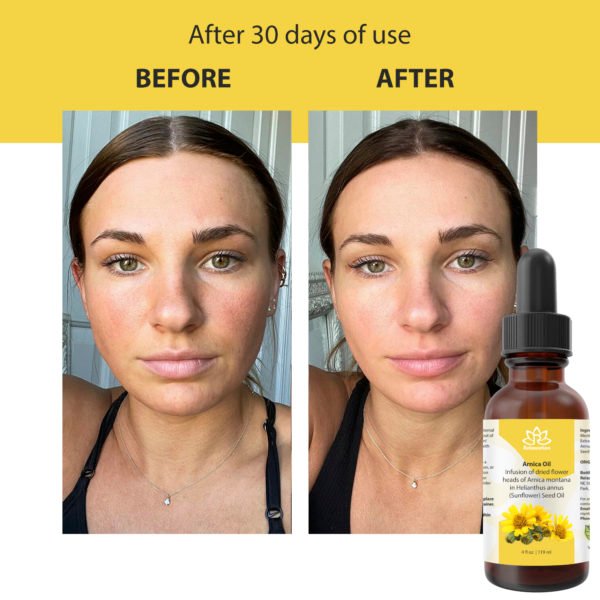 Pure Arnica Organic Oil - Image 10