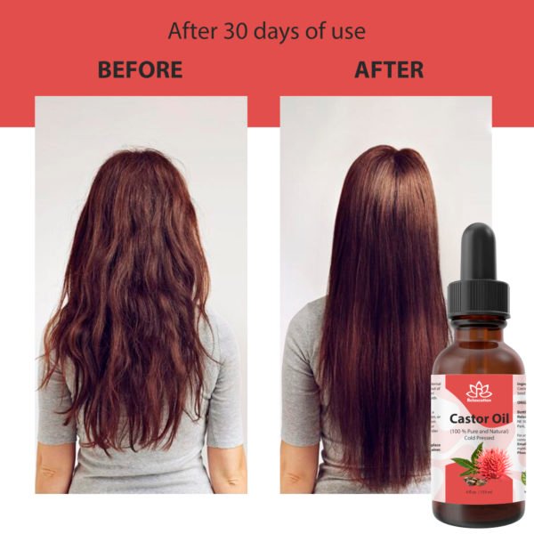 Castor oil - Image 9
