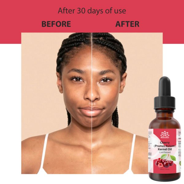 Pure Cherry Kernel Oil - Image 10