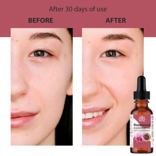 Rosewood Essential Oil in Amber Bottle - Image 10