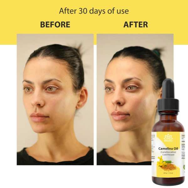 Vitamin E Oil – Ultra Moisture & Defense - Image 10