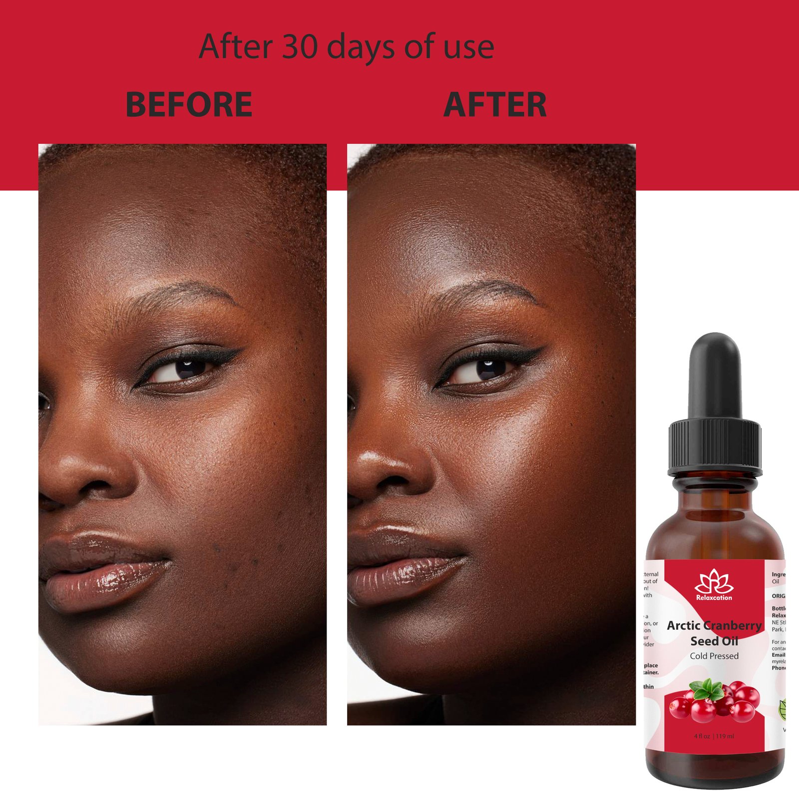 Arctic Cranberry Seed Oil Cold Pressed | Pure Vaccinium Macrocarpon Oil | Natural Facial Oil | Hair And Skin Carrier Oil Choose 0.5–4 oz - Image 10
